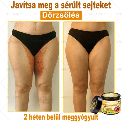 🐝🐝APKAPK® Méhméreg Átfogó Krém🔥 Magyar fejlesztés, magyarországi gyártás és szállítás