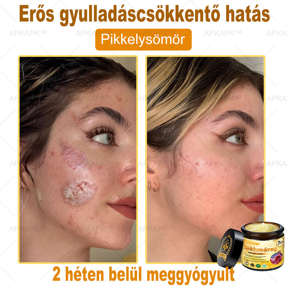 🐝🐝APKAPK® Méhméreg Átfogó Krém🔥 Magyar fejlesztés, magyarországi gyártás és szállítás
