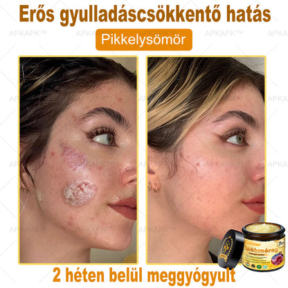 🐝🐝APKAPK® Méhméreg Átfogó Krém🔥 Magyar fejlesztés, magyarországi gyártás és szállítás