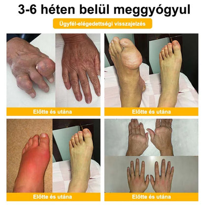 🐝🌿🐝 BEARNICA™ Bee Venom Advanced ízület- és csontkezelő krém🔥 (Utolsó napi akció, 80% kedvezmény)