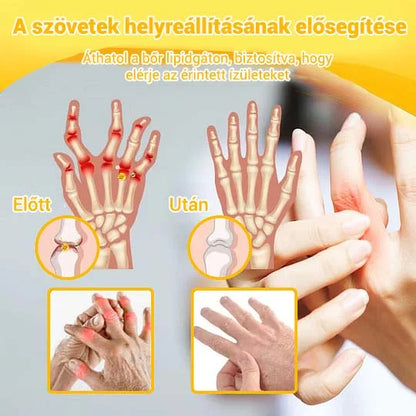 🐝🌿🐝 BEARNICA™ Bee Venom Advanced ízület- és csontkezelő krém🔥 (Utolsó napi akció, 80% kedvezmény)