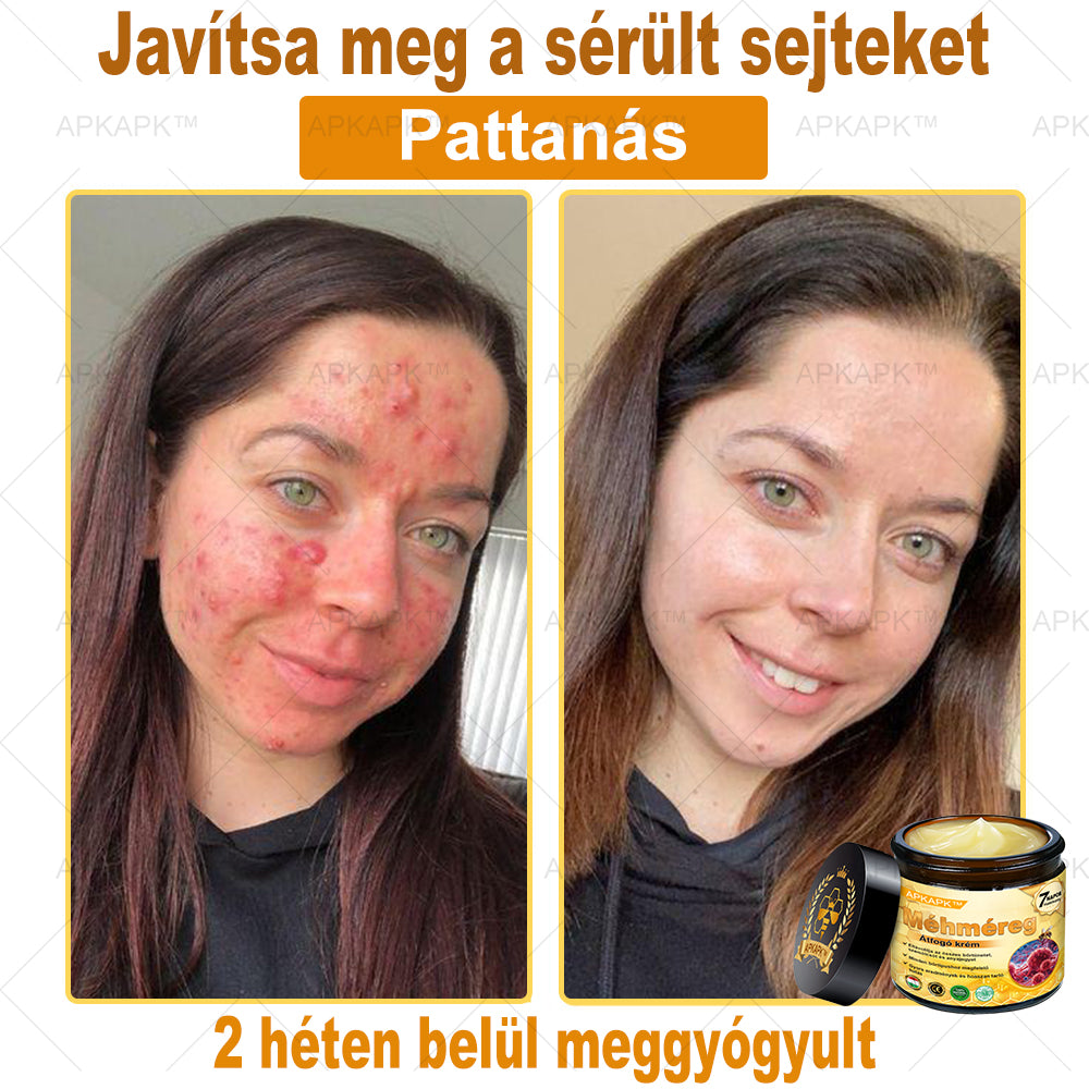 🐝🐝APKAPK® Méhméreg Átfogó Krém🔥 Magyar fejlesztés, magyarországi gyártás és szállítás