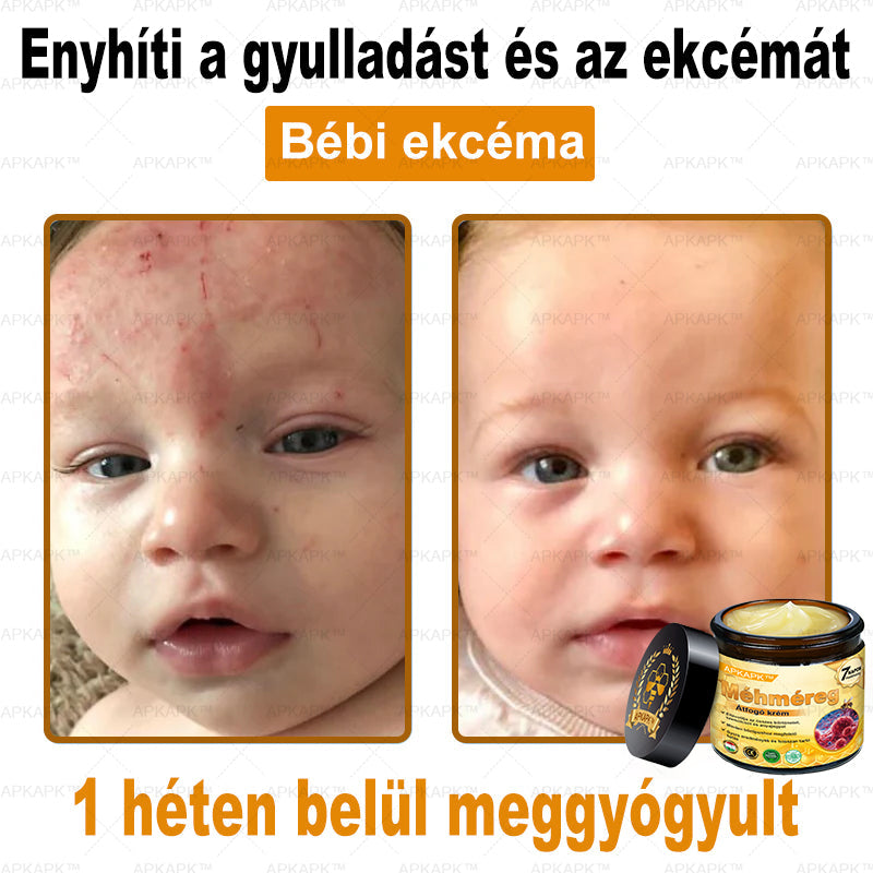 🐝🐝APKAPK® Méhméreg Átfogó Krém🔥 Magyar fejlesztés, magyarországi gyártás és szállítás