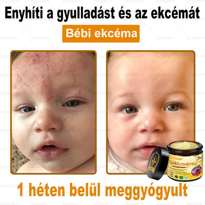 🐝🐝APKAPK® Méhméreg Átfogó Krém🔥 Magyar fejlesztés, magyarországi gyártás és szállítás