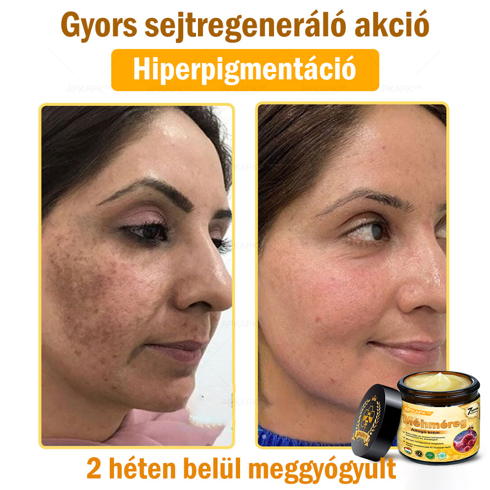 🐝🐝APKAPK® Méhméreg Átfogó Krém🔥 Magyar fejlesztés, magyarországi gyártás és szállítás