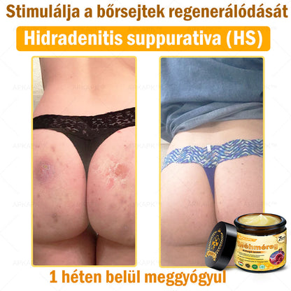 🐝🐝APKAPK® Méhméreg Átfogó Krém🔥 Magyar fejlesztés, magyarországi gyártás és szállítás