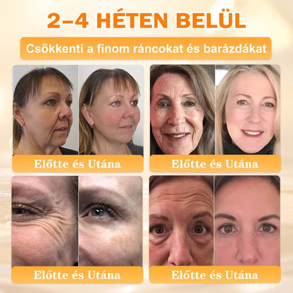 🐝🐝APKAPK® Méhméreg Átfogó Krém🔥 Magyar fejlesztés, magyarországi gyártás és szállítás