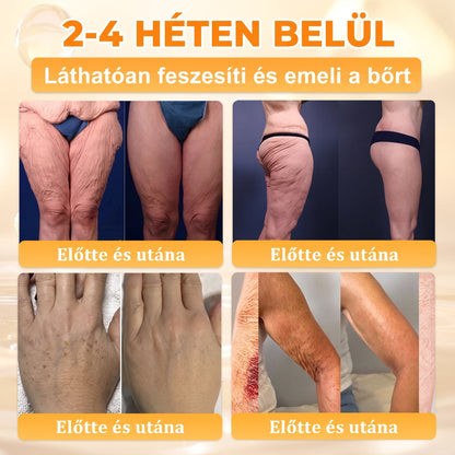 🐝🐝APKAPK® Méhméreg Átfogó Krém🔥 Magyar fejlesztés, magyarországi gyártás és szállítás